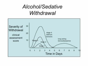 malibu_drug_rehab_alcohol_withdrawal_symptoms_chart